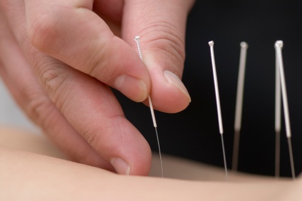 Traditional Korean medicine applying acupuncture